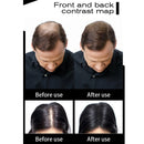 Applying Treatment Unisex Hair Loss Products to scalp