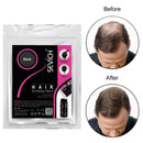 Applying Treatment Unisex Hair Loss Products to scalp