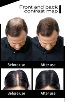 Applying Treatment Unisex Hair Loss Products to scalp
