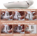 Using Care Tool Dead Hard Skin Callus USB on feet