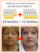 No fine lines ,From wrinkles and does not look old