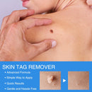 2 IN 1 Auto Micro Skin Tag Remover Device Standard And Micro Skin Tag Removal Kit Adult Mole Wart Remover Face Care Beauty Tools