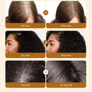 Baldness Treatment Hair Health Care nourishing formula