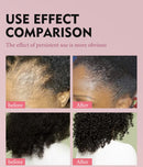Baldness Treatment Hair Health Care nourishing formula