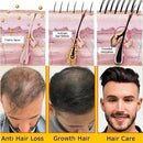 Baldness Treatment Hair Health Care nourishing formula