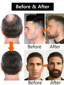 "The Most Effective Beard Growth nourishing beard formula"