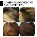 Baldness Treatment Hair Health Care nourishing formula