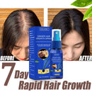 "Growth Spray Anti Hair Fall Hair Loss treatment for hair growth"