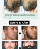 "The Most Effective Beard Growth nourishing beard formula"