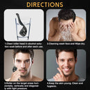 0.2-0.3mm Microneedle for Facial Body Hair Growth Derma Roller for Skin Beard 540 Needles Micro Face Roll Tool