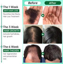 Nourishing Roots Regrowth Hair For treatment bottle