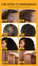 Baldness Treatment Hair Health Care nourishing formula