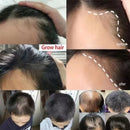 Baldness Treatment Hair Health Care nourishing formula