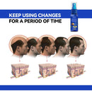 "Growth Spray Anti Hair Fall Hair Loss treatment for hair growth"
