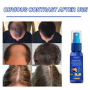 "Growth Spray Anti Hair Fall Hair Loss treatment for hair growth"