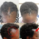 Nourishing Roots Regrowth Hair For treatment bottle