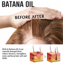 Baldness Treatment Hair Health Care nourishing formula