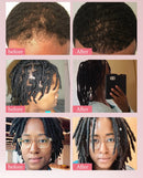 Baldness Treatment Hair Health Care nourishing formula