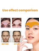 The Forehead Wrinkle Patch Can Lift The Face And Tighten The Skin The Forehead Patch Can Fade And Smooth The Forehead Wrinkles