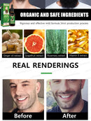 "The Most Effective Beard Growth nourishing beard formula"