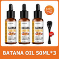 "Lewedo Naturals Batana Oil Fast Hair bottle"