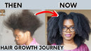 Baldness Treatment Hair Health Care nourishing formula