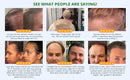 Baldness Treatment Hair Health Care nourishing formula