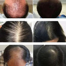 Nourishing Roots Regrowth Hair For treatment bottle