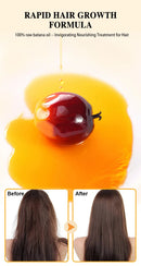 Baldness Treatment Hair Health Care nourishing formula