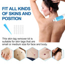 2 IN 1 Auto Micro Skin Tag Remover Device Standard And Micro Skin Tag Removal Kit Adult Mole Wart Remover Face Care Beauty Tools