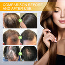 Follicle Reduce Hair Loss Stabiliz Hair Root nourishing formula