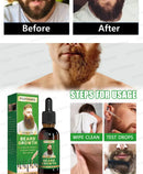 "The Most Effective Beard Growth nourishing beard formula"