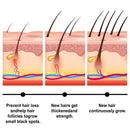 Baldness Treatment Hair Health Care nourishing formula