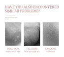 Soft skin with Foot Peeling Mask Exfoliating Treatment