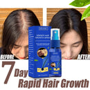 "Growth Spray Anti Hair Fall Hair Loss treatment for hair growth"
