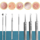 1/11Pcs Acne Pimples Blackhead Remover Clip Ultra-fine Tweezers Black Dots Blackhead Extractor Acne Needle Facial Cleaner Skin
