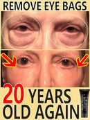 Eye Bags Cream Instant Removes Dark Circles Tightens The Eyes Lifting Firming And Removing Eye Bags Make Your Eyes More Lively