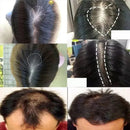 Baldness Treatment Hair Health Care nourishing formula