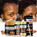 Baldness Treatment Hair Health Care nourishing formula